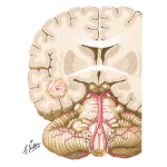 Causes of Vertigo
