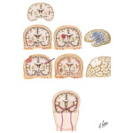 Causes of Seizures