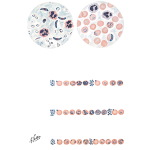 Malaria: Clinical Course and Diagnosis