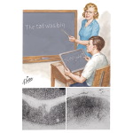 Developmental Dyslexia