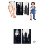 Unlabeled image