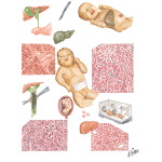 Jaundice in the Neonatal Period