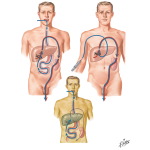 Detoxification: Hippuric Acid Formation