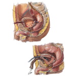 Trauma to the Bladder