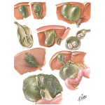 Congenital Anomalies