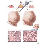 Functional Changes and Lactation