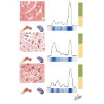 Tests Related to Protein Metabolism (Flocculation, Turbidity and Fractionation Tests)