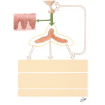 Cause and Results of Primary Chronic Adrenal Insufficiency (Addison's Disease)