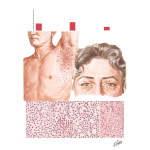 Normocholesterolemic Eosinophilic Xanthomatous Granuloma