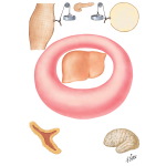 Insulin Excess