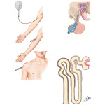 Tests for Diabetes Insipidus
