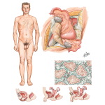 Disorders of Sex Differentiation