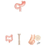 Uric Acid Metabolism, Gout