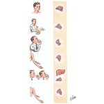 Tests for Diabetes and Prediabetes