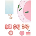 Etiology of Nontoxic Goiter and Nontoxic Adenoma