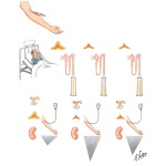 Tests for Addison's Disease