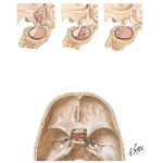 Nontumorous Lesions of the Pituitary Gland