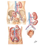 Ectopia of the Kidney
