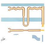 Normal Pattern of Sodium Reabsorption