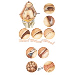 Synovial Plica