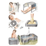Physical Therapy for Arthritis