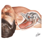 Disorders of the Shoulder