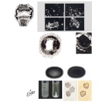 Immunologic Features in Rheumatoid Arthritis