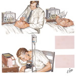 Noninvasive Tests for Carotid Artery Blood Flow