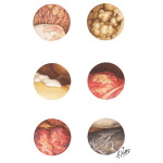 Synovial Pathology