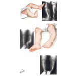Unlabeled image