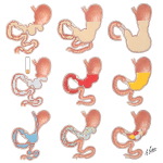 Factors Influencing Gastric Activitiy