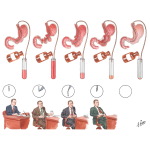 Functional Changes in Gastric Diseases