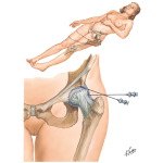 The Hip
