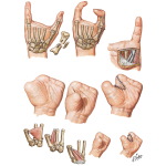 Additional Procedures to Improve Function