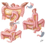 Principles of Operative Procedures
