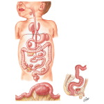 Duplications of Alimentary Tract