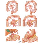 marginal artery colon