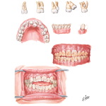 Dental Abnormalities