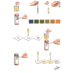 Urine Examination