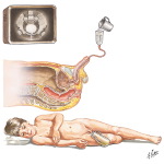 Cystourethrography