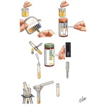 Urine Examination