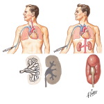 Nephrotomography