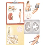 Common Clinical and Laboratory Features of Chronic Pyelonephritis
