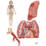 Acute Cor Pulmonale