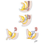 Development of the Urinary Bladder