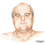 Face of Overweight Man