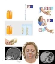 Tests Used In the Diagnosis of Cushing's Syndrome