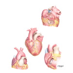 Congenital Coronary Artery Anomalies