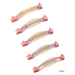Performance of Percutaneous Coronary Intervention: Stent Deployment