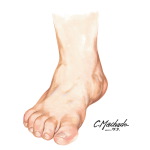 Foot: Diminished Circulation